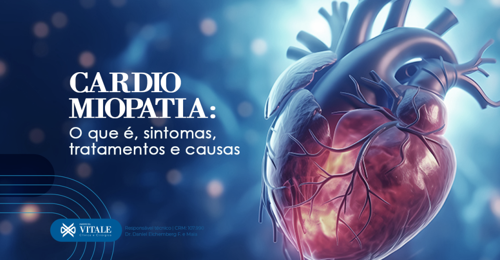 Cardiomiopatia: O que é, sintomas, tratamentos e causas