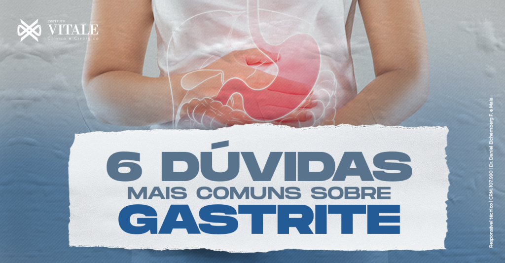 6 dúvidas mais comuns sobre gastrite